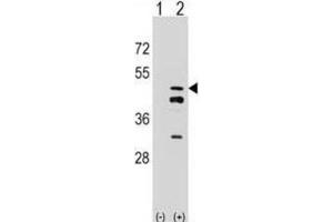 Western Blotting (WB) image for anti-Farnesyl Diphosphate Synthase (FDPS) antibody (ABIN2998304) (FDPS anticorps)