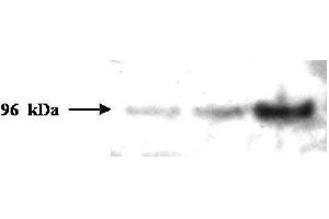 Western blot analysis is shown using  Protein A Purified Mouse Monoclonal Anti-PMS2 antibody to detect human PMS2 protein present in H157 cell lysates. (PMS2 anticorps)