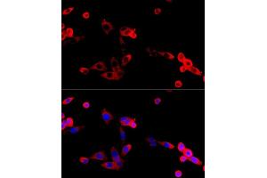Immunofluorescence analysis of NIH/3T3 cells using FGFR2 antibody (ABIN6130457, ABIN6140615, ABIN6140617 and ABIN6216059) at dilution of 1:100 (40x lens).