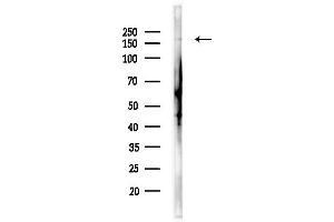 Western blot analysis of lysates from Hela cells(heat-shock,45 min treatment), using Brm Antibody at 1/1000 dilution.