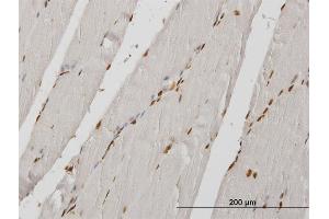 Immunoperoxidase of monoclonal antibody to HIRIP3 on formalin-fixed paraffin-embedded human skeletal muscle.