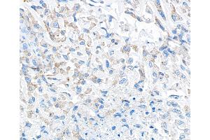 Immunohistochemistry (IHC) image for anti-Transforming Growth Factor, beta 1 (TGFB1) (AA 325-375) antibody (ABIN7449529)