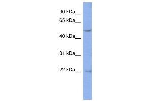 WB Suggested Anti-DAZ3  Antibody Titration: 0. (DAZ3 anticorps  (Middle Region))