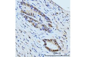 IHC analysis of SBNO1 using anti-SBNO1 antibody (ABIN7601710). (SBNO1 anticorps  (AA 43-1303))