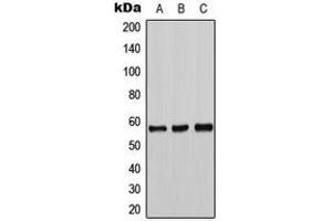 Western blot analysis of Tyrosine Hydroxylase expression in DLD (A), mouse liver (B), PC12 (C) whole cell lysates. (Tyrosine Hydroxylase anticorps  (N-Term))