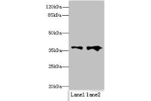Western blot All lanes: RPRD1B antibody at 0. (RPRD1B anticorps  (AA 2-172))