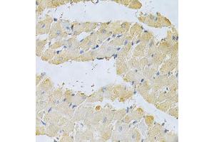 Immunohistochemistry of paraffin-embedded rat heart using PPA1 Antibody (ABIN5971134) at dilution of 1/200 (40x lens). (Pyrophosphatase (Inorganic) 1 (PPA1) anticorps)