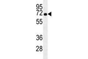 HSPA1A antibody western blot analysis in HL-60 lysate.