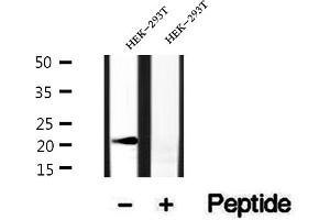 Western blot analysis of extracts of HEK-293T cells, using BBS3 antibody. (ARL6 anticorps  (Internal Region))
