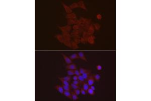 Immunofluorescence analysis of HeLa using S100 antibody (ABIN7270123) at dilution of 1:25 (40x lens).