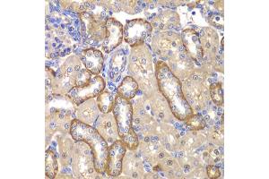 Immunohistochemistry of paraffin-embedded rat kidney using MMP14 antibody. (MMP14 anticorps)