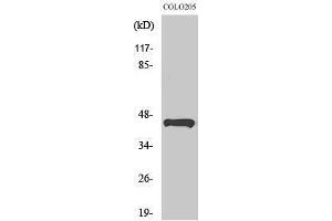 Western Blotting (WB) image for anti-Tumor Suppressor Candidate 3 (TUSC3) (Internal Region) antibody (ABIN3176197) (TUSC3 anticorps  (Internal Region))