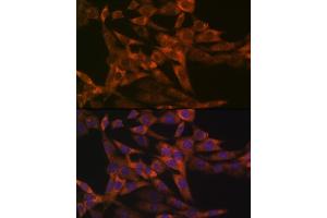 Immunofluorescence analysis of NIH-3T3 cells using IRF6 Rabbit mAb (ABIN1680921, ABIN3017588, ABIN3017589 and ABIN7101507) at dilution of 1:100 (40x lens).