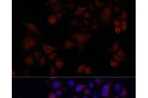 Immunofluorescence analysis of HeLa cells using MAPRE1 Polyclonal Antibody at dilution of 1:100. (MAPRE1 anticorps)