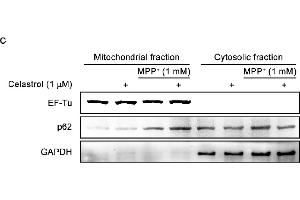 Celastrol enhances the clearance of damaged mitochondria via activating mitophagy.