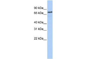 WB Suggested Anti-MARCH7 Antibody Titration:  0. (MARCH7 anticorps  (Middle Region))