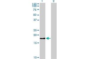 Western Blot analysis of BIRC5 expression in transfected 293T cell line by BIRC5 monoclonal antibody (M01), clone 5B10. (Survivin anticorps  (AA 1-100))