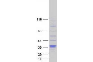 Validation with Western Blot (DHRS7B Protein (Myc-DYKDDDDK Tag))