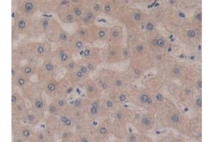 Detection of BCAS3 in Human Liver Tissue using Polyclonal Antibody to Breast Carcinoma Amplified Sequence 3 (BCAS3)