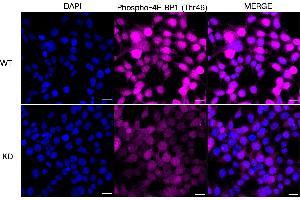 Immunocytochemical staining of HeLa cells using Phospho-4E BP1 (Thr46) antibody (ABIN7798530), 1:1,000), Top panel: wild-type (WT), Bottom panal: Phospho-4E BP1 (Thr46) shRNA knockdown (KD). (Recombinant eIF4EBP1 anticorps  (pThr46))