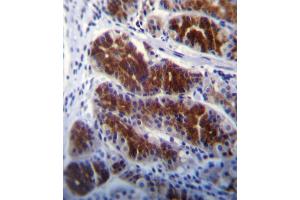 FRK Antibody (N-term) (ABIN392097 and ABIN2841849) immunohistochemistry analysis in formalin fixed and paraffin embedded human stomach tissue followed by peroxidase conjugation of the secondary antibody and DAB staining. (FRK anticorps  (N-Term))