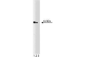 Western blot analysis of NF-kappaB p65 on a Jurkat lysate. (NF-kB p65 anticorps  (AA 136-224))