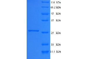 Ephrin B3 (EFNB3) (AA 28-227) protein (His tag)
