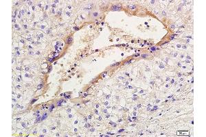 Formalin-fixed and paraffin embedded rabbit placenta labeled with Anti- PGT Polyclonal Antibody, Unconjugated at 1:200 followed by conjugation to the secondary antibody and DAB staining