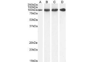 ABIN185319 (1 µg/ml) staining of HeLa (A), U251 (B), KNRK (C) and (0.