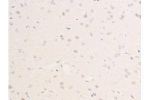 ABIN6267223 at 1/100 staining rat brain tissue sections by IHC-P.
