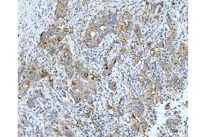 IHC analysis of Neurofibromin/NF1 using anti-Neurofibromin/NF1 antibody (ABIN7600197). (Neurofibromin 1 anticorps  (AA 160-270))