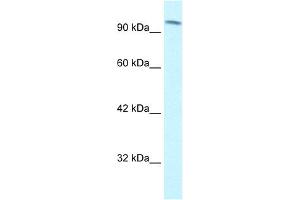 WB Suggested Anti-SMARCC1 Antibody Titration: 1. (SMARCC1 anticorps  (C-Term))
