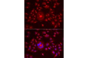 Immunofluorescence analysis of A549 cells using GORASP1 antibody (ABIN5973972). (GORASP1 anticorps)