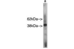 Image no. 1 for anti-Sterile alpha Motif Domain Containing 8 (SAMD8) antibody (ABIN793629) (SAMD8 anticorps)