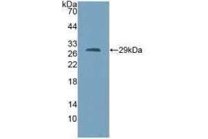 Detection of Recombinant AGA, Mouse using Polyclonal Antibody to Aspartylglucosaminidase (AGA) (AGA anticorps  (AA 24-260))