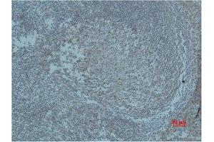 Immunohistochemistry (IHC) analysis of paraffin-embedded Human Tonsil Tissue using HIF-1beta Polyclonal Antibody. (ARNT anticorps)