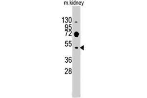 Western blot analysis of Evx2 polyclonal antibody  in mouse kidney tissue lysates (35 ug/lane). (EVX2 anticorps  (C-Term))