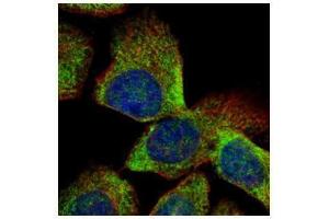 ICC/IF Image Confocal immunofluorescence analysis (Olympus FV10i) of methanol-fixed A431, using VTA1, antibody (Green) at 1:500 dilution.