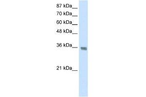 WB Suggested Anti-HNRPA1 Antibody Titration:  1. (HNRNPA1 anticorps  (C-Term))