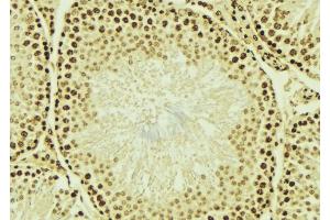 ABIN6276700 at 1/100 staining Mouse testis tissue by IHC-P. (HDAC9 anticorps  (C-Term))