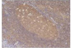 Image no. 1 for anti-Chemokine (C-C Motif) Ligand 5 (CCL5) antibody (ABIN465158) (CCL5 anticorps)