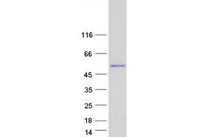 Validation with Western Blot