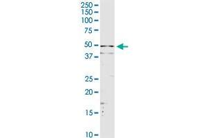 SERPINA3 MaxPab rabbit polyclonal antibody.
