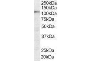 Squamous Cell Carcinoma Antigen Recognized By T Cells (SART1) peptide