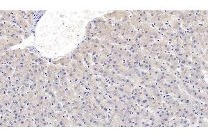 Detection of SEMA3A in Human Liver Tissue using Monoclonal Antibody to Semaphorin 3A (SEMA3A) (SEMA3A anticorps  (AA 580-664))