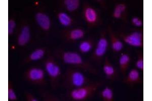 Immunofluorescence staining of methanol-fixed HeLa cells using MEF2A (phospho-Thr312) antibody (E011039, Red) (MEF2A anticorps  (pThr312))