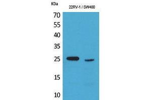 Western Blotting (WB) image for anti-Synovial Sarcoma, X Breakpoint 2B (SSX2B) (C-Term) antibody (ABIN3187724) (Synovial Sarcoma, X Breakpoint 2B (SSX2B) (C-Term) anticorps)