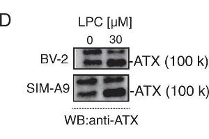 The autotaxin (ATX) inhibitor BI-2545 promotes lysophosphatidylcholine (LPC) -mediated cell morphology.