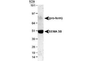 Western blot analysis of SEMA3B in mouse E16 cerebellum lysate with SEMA3B polyclonal antibody . (SEMA3B anticorps  (AA 100-200))