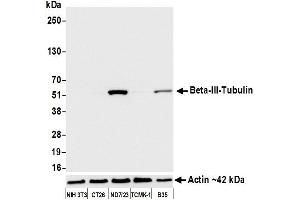 Western Blotting (WB) image for anti-Tubulin, beta 3 (TUBB3) (AA 400-450) antibody (ABIN7453957) (Recombinant TUBB3 anticorps  (AA 400-450))